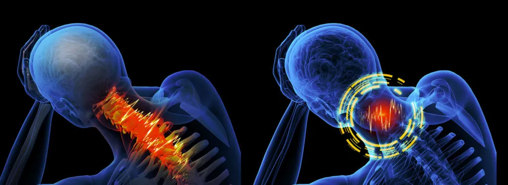 Common Causes of Spinal Cord Injuries