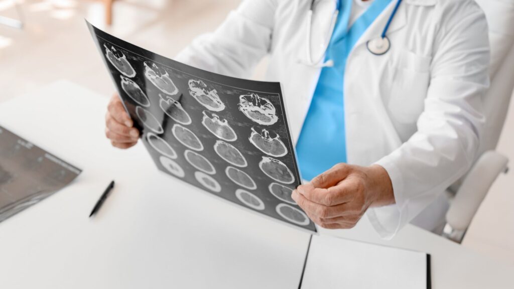 A doctor looking at a brain x-ray.