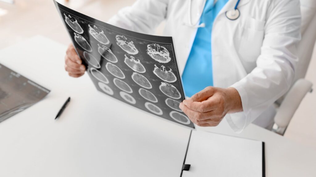 A doctor looking at an x-ray of a person's brain.