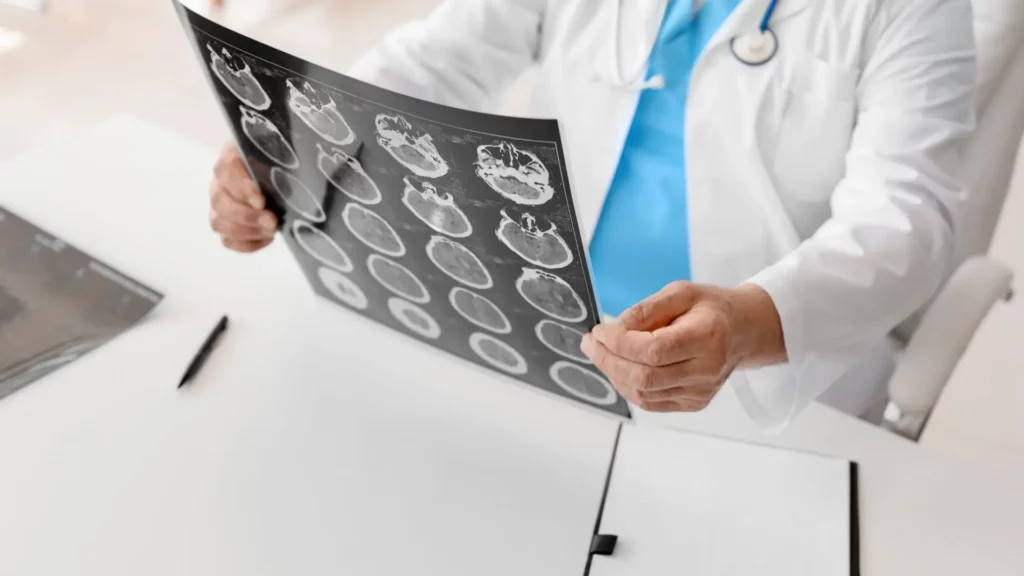A doctor looking at an x-ray of a person's brain.