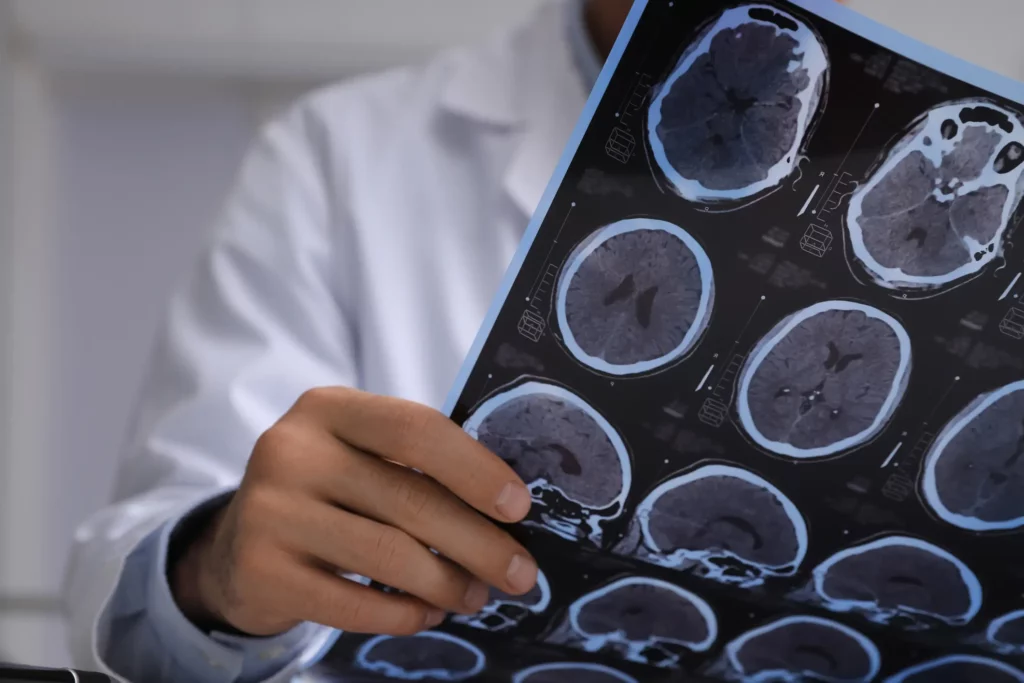 A doctor holding a person's brain x-rays.