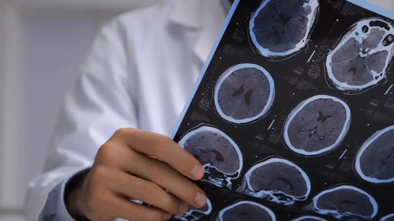 Síntomas de Lesión Cerebral que Afectan Su Reclamación en California