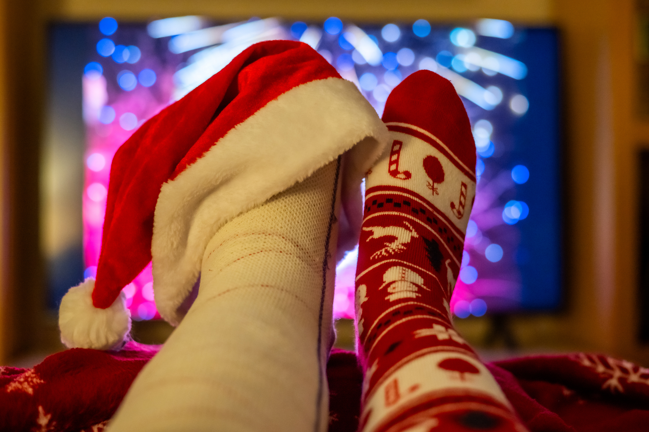 A cast with a santa hat and a foot with a holiday sock.