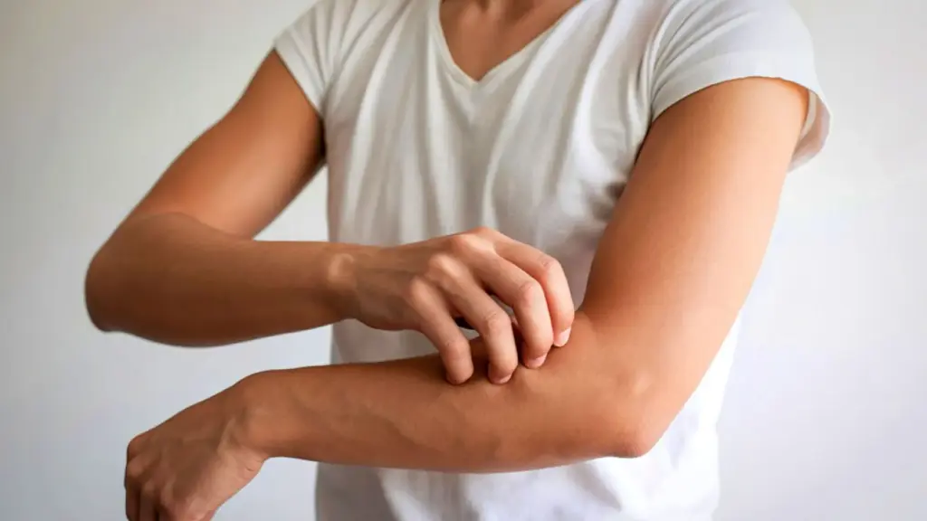 A person scratching their arms.