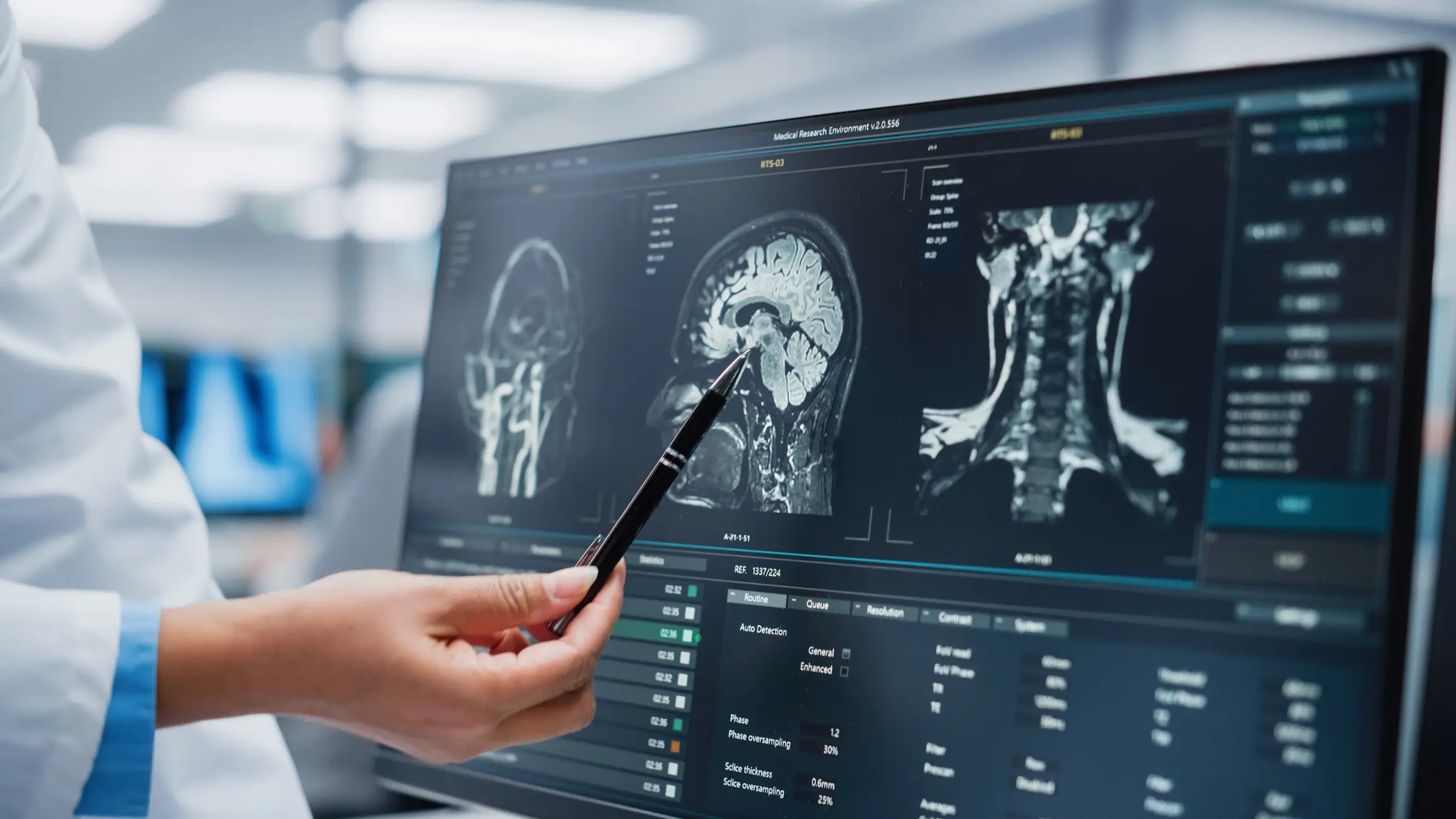 A doctor examining brain x-rays.